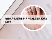 为什么身上经常起癣 为什么身上经常起癣怎么回事