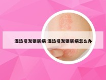 湿热引发银屑病 湿热引发银屑病怎么办