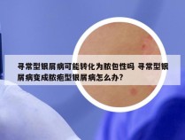 寻常型银屑病可能转化为脓包性吗 寻常型银屑病变成脓疱型银屑病怎么办?