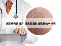 银屑病和消银片 银屑胶囊和消银颗粒一样吗
