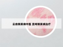 云南银屑病中医 昆明银屑病治疗