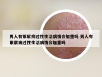 男人有银屑病过性生活病情会加重吗 男人有银屑病过性生活病情会加重吗