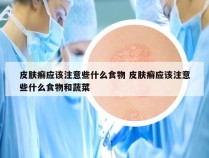 皮肤癣应该注意些什么食物 皮肤癣应该注意些什么食物和蔬菜
