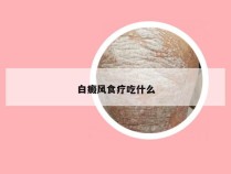 白癜风食疗吃什么