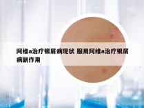 阿维a治疗银屑病现状 服用阿维a治疗银屑病副作用