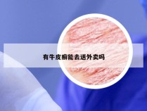 有牛皮癣能去送外卖吗