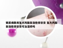 银屑病敢用复方丙酸氯倍他索软膏 复方丙酸氯倍他索软膏可治湿疹吗