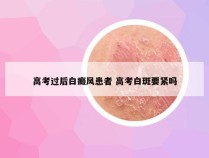 高考过后白癜风患者 高考白斑要紧吗