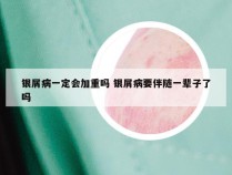 银屑病一定会加重吗 银屑病要伴随一辈子了吗