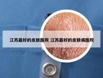 江苏最好的皮肤医院 江苏最好的皮肤病医院