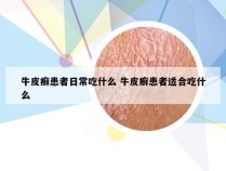 牛皮癣患者日常吃什么 牛皮癣患者适合吃什么
