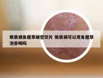 银屑病鱼腥草破壁饮片 银屑病可以用鱼腥草泡茶喝吗