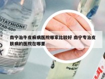 南宁治牛皮癣病医院哪家比较好 南宁专治皮肤病的医院在哪里