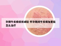 孕期牛皮癣症状减轻 怀孕期间牛皮癣加重能怎么治疗