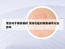 发热对于银屑病的 发烧引起的银屑病可以治愈吗
