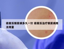 修美乐银屑病多久一针 修美乐治疗银屑病用法用量
