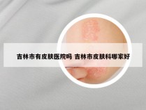吉林市有皮肤医院吗 吉林市皮肤科哪家好
