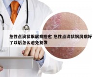 急性点滴状银屑病痊愈 急性点滴状银屑病好了以后怎么避免复发
