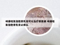 咪康唑氯倍他索乳膏可以治疗银屑病 咪康唑氯倍他索乳膏止痒么