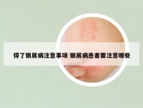 得了银屑病注意事项 银屑病患者要注意哪些