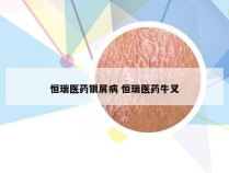 恒瑞医药银屑病 恒瑞医药牛叉
