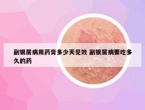 副银屑病用药膏多少天见效 副银屑病要吃多久的药