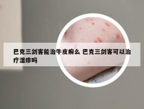 巴克三剑客能治牛皮癣么 巴克三剑客可以治疗湿疹吗