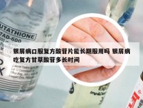 银屑病口服复方酸苷片能长期服用吗 银屑病吃复方甘草酸苷多长时间