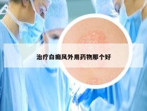 治疗白癜风外用药物那个好