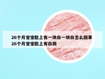 26个月宝宝脸上有一块白一块白怎么回事 26个月宝宝脸上有白斑