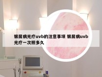 银屑病光疗uvb的注意事项 银屑病uvb光疗一次照多久