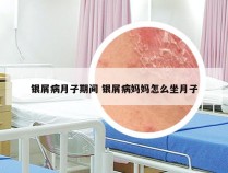 银屑病月子期间 银屑病妈妈怎么坐月子
