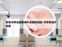 求用浮萍治银屑病牛皮癣的经验 浮萍草治疗皮肤