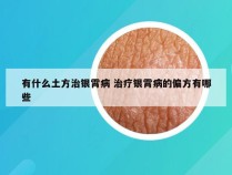 有什么土方治银霄病 治疗银霄病的偏方有哪些