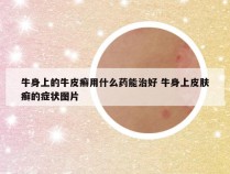 牛身上的牛皮癣用什么药能治好 牛身上皮肤癣的症状图片