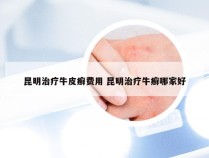 昆明治疗牛皮癣费用 昆明治疗牛癣哪家好
