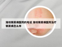 潍坊银屑病医院的电话 潍坊银屑病医院治疗银屑病怎么样