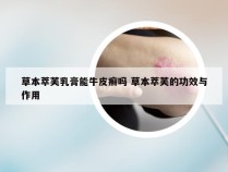 草本萃芙乳膏能牛皮癣吗 草本萃芙的功效与作用