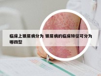 临床上银屑病分为 银屑病的临床特征可分为哪四型