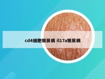 cd4细胞银屑病 il17a银屑病