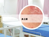 身上廨