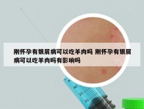 刚怀孕有银屑病可以吃羊肉吗 刚怀孕有银屑病可以吃羊肉吗有影响吗