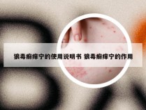 狼毒癣痒宁的使用说明书 狼毒癣痒宁的作用