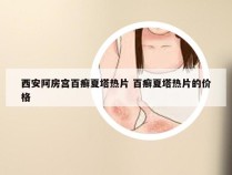 西安阿房宫百癣夏塔热片 百癣夏塔热片的价格
