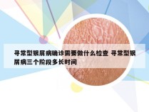 寻常型银屑病确诊需要做什么检查 寻常型银屑病三个阶段多长时间