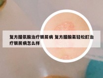 复方醋氨酸治疗银屑病 复方醋酸氟轻松酊治疗银屑病怎么样