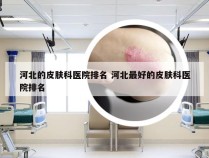 河北的皮肤科医院排名 河北最好的皮肤科医院排名