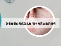 张书元看白殿疯怎么样 张书元真会治的斑吗