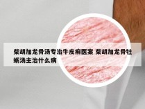 柴胡加龙骨汤专治牛皮癣医案 柴胡加龙骨牡蛎汤主治什么病