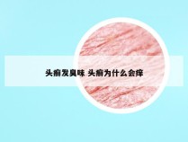 头癣发臭味 头癣为什么会痒